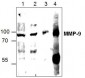 MMP-9 Antibody